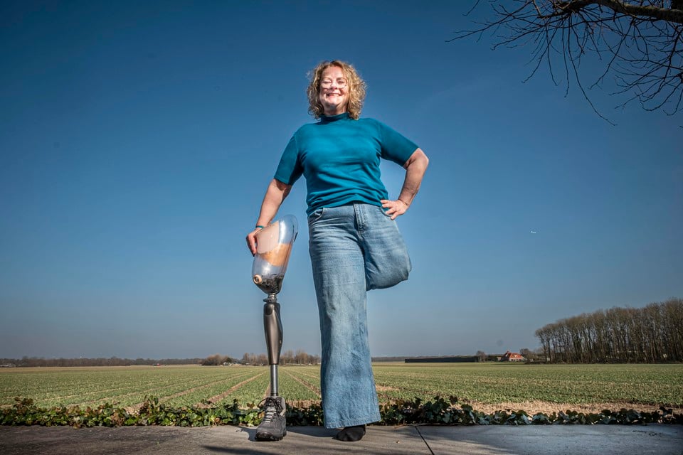 Hanneke Mooij met haar laatste prothese waar ze niet meer op kon lopen.