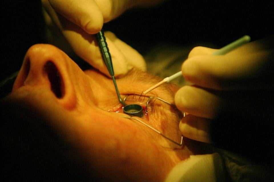 Met de subsidie van Horizon2020 kan het LUMC het onderzoek naar oogziekten een impuls geven. Foto Joop Boek